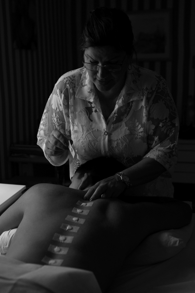 Acupuntura em Porto Alegre